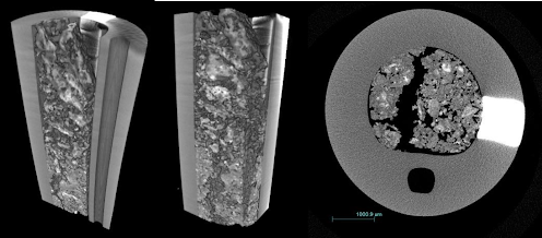 Wilks, S., Katsamenis, O., Carugo, D., Zhang, X., Fader, M., & Keevil, C. (1970, January 1). [PDF] the use of X-ray micro computed tomography (μ-CT) to understand crystalline biofilm blockage in urinary catheters: Semantic scholar. The use of X-Ray micro computed tomography (μ-CT) to understand crystalline biofilm blockage in urinary catheters. Retrieved May 16, 2022, from https://www.semanticscholar.org/paper/The-use-of-X-Ray-micro-computed-tomography-(%CE%BC-CT)-Wilks-Katsamenis/989692d68cc8b3ad296dddcc499d3a0ddbe297a5 